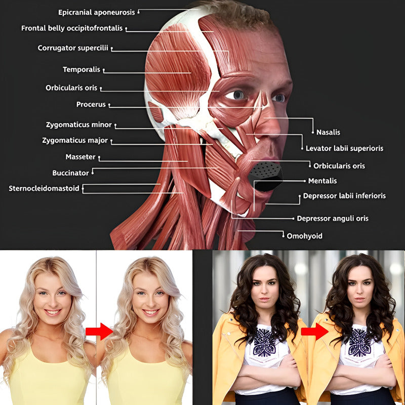 Aparato De Entrenamiento Mandibular Muscular Facial Negro