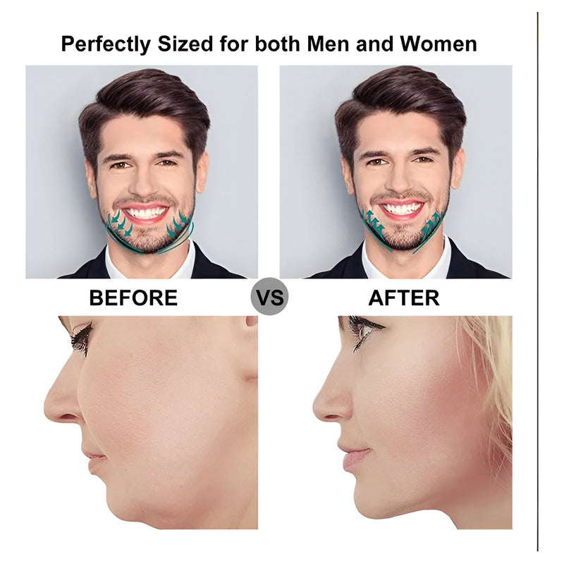 Aparato De Entrenamiento Mandibular Muscular Facial Negro