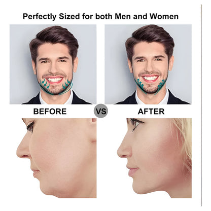 Aparato De Entrenamiento Mandibular Muscular Facial Negro